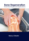 Bone Regeneration: Novel Techniques and Applications By Nancy Chisolm (Editor) Cover Image