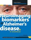 Neuroimaging biomarkers in Alzheimer's disease By Samuel Barrack Cover Image