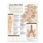 Understanding Low Back Pain Anatomical Chart Cover Image