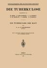 Die Tuberkulose Der Haut (Enzyklopaedie Der Klinischen Medizin) By F. Lewandowsky, L. Langstein (Editor), C. Von Noorden (Editor) Cover Image