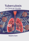 Tuberculosis: A Clinical Guide By Ralphie Clark (Editor) Cover Image