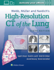 Webb, Müller and Naidich's High-Resolution CT of the Lung By Sujal Desai, David Lynch, Brett M. Elicker, MD, Anand Devaraj, Nicola Sverzellati Cover Image