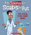 The Science of Scabs and Pus: The Sticky Truth About Blood (The Science of the Body) (The Science of...) By Ian Graham Cover Image