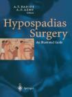 Hypospadias Surgery: An Illustrated Guide Cover Image