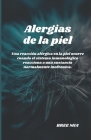 Alergias de la piel: Una reacción alérgica en la piel ocurre cuando el sistema inmunológico reacciona a una sustancia normalmente inofensiv Cover Image