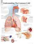The Common Cold Chart: Laminated Wall Chart Cover Image