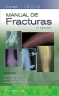Manual de fracturas By Kenneth Egol, MD Cover Image