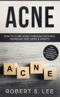 Acne: How to Cure Acne through Natural Remedies and Simple Habits. Say Goodbye to Pustules, Blackheads and Whiteheads for Go Cover Image