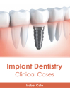 Implant Dentistry: Clinical Cases By Isobel Cole (Editor) Cover Image