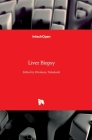 Liver Biopsy By Hirokazu Takahashi (Editor) Cover Image