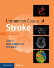 Uncommon Causes of Stroke Cover Image