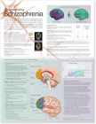 Understanding Schizophrenia Anatomical Chart By Anatomical Chart Company (Prepared for publication by) Cover Image