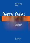 Dental Caries: Principles and Management Cover Image