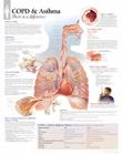 Copd/Asthma Chart: Laminated Wall Chart Cover Image