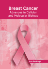 Breast Cancer: Advances in Cellular and Molecular Biology By Ava Santiago (Editor) Cover Image