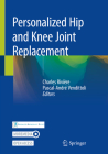 Personalized Hip and Knee Joint Replacement Cover Image