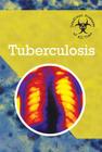Tuberculosis (Deadliest Diseases of All Time) Cover Image