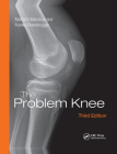 The Problem Knee By Malcolm MacNicol, Franky Steenbrugge Cover Image