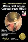 Manual Small Incision Cataract Surgery (Msics) (Anshan Gold Standard Mini Atlas) Cover Image