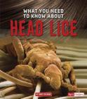 What You Need to Know about Head Lice (Focus on Health) By Nancy Dickmann Cover Image