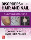 Disorders of the Hair and Nail: Diagnosis and Treatment Cover Image