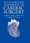 Illustrated Handbook of Cardiac Surgery (Applied Mathematical Sciences; 109) By Bradley J. Harlan, Albert Starr, Fredric M. Harwin Cover Image