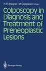 Colposcopy in Diagnosis and Treatment of Preneoplastic Lesions By Hans-E Stegner (Editor), Malcolm Coppleson (Editor) Cover Image