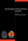 Neuroimaging and the Psychiatry of Late Life Cover Image