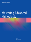 Mastering Advanced Rhinoplasty Cover Image