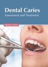 Dental Caries: Assessment and Treatment Cover Image