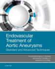 Endovascular Treatment of Aortic Aneurysms: Standard and Advanced Techniques Cover Image