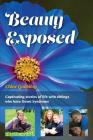 Beauty Exposed: Captivating stories of life with siblings who have Down syndrome By Chloe Michelle Goulding Cover Image