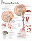 Understanding Stroke Chart: Laminated Wall Chart Cover Image