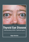 Thyroid Eye Disease: Understanding Graves' Ophthalmopathy Cover Image