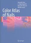 Color Atlas of Nails By Antonella Tosti, Ralph Daniel, Bianca Maria Piraccini Cover Image