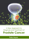 A New Approach to Diagnosis and Treatment of Prostate Cancer By Peter Hayes (Editor) Cover Image
