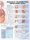 Sexually Transmitted Infections Anatomical Chart Cover Image