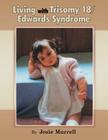 Living with Trisomy 18 / Edwards Syndrome By Josie Murrell Cover Image