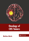 Oncology of CNS Tumors Cover Image