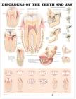Disorders of the Teeth and Jaw Anatomical Chart Cover Image