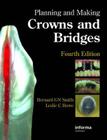 Planning and Making Crowns and Bridges Cover Image