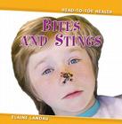 Bites and Stings (Head-To-Toe Health #1) By Elaine Landau Cover Image