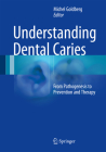 Understanding Dental Caries: From Pathogenesis to Prevention and Therapy By Michel Goldberg (Editor) Cover Image