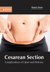 Cesarean Section: Complications of Labor and Delivery Cover Image