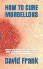 How to Cure Morgellons: HOW TO CURE MORGELLONS: The Complete Guide On Everything You Need To Know How To Cure Morgellons Cover Image