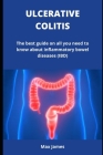 Ulcerative Colitis: The best guide on all you need to know about inflammatory bowel diseases (IBD) By Max James Cover Image