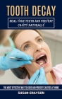 Tooth Decay: Heal Your Teeth and Prevent Cavity Naturally (The Most Effective Way to Cure and Prevent Cavities at Home) By Susan Grayson Cover Image