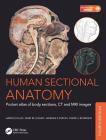 Human Sectional Anatomy: Pocket Atlas of Body Sections, CT and MRI Images, Fourth Edition Cover Image