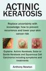 Actinic Keratosis. Replace the Fear and Uncertainty with Knowledge: How to Prevent Recurrence and Lower Your Skin Cancer Risk. Cover Image
