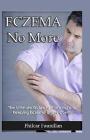 Eczema Cure: Eczema No More - The Ultimate Guide to Knowing and Keeping Eczema Under Control By Fhilcar Faunillan Cover Image